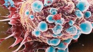 Penelitian mengamati protein penting yang terdapat pada sel kanker.