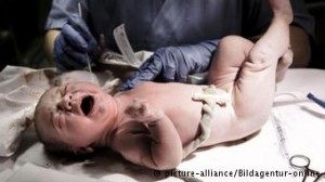 Bayi yang baru lahir bisa terinfeksi gonore