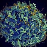 Upaya Pencegahan HIV Meningkat, Namun Tidak Seorang Pun Boleh Ditinggalkan