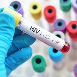 Penelitian Pertama di Dunia Mengeksplorasi Pengalaman Orang yang Baru Didiagnosis Dengan HIV