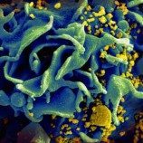 Vaksin HIV Inovatif Memasuki Pengujian Tahap Akhir di Amerika dan Eropa