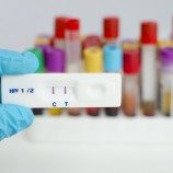 Mengapa Tes HIV Penting untuk Kesehatan Trans